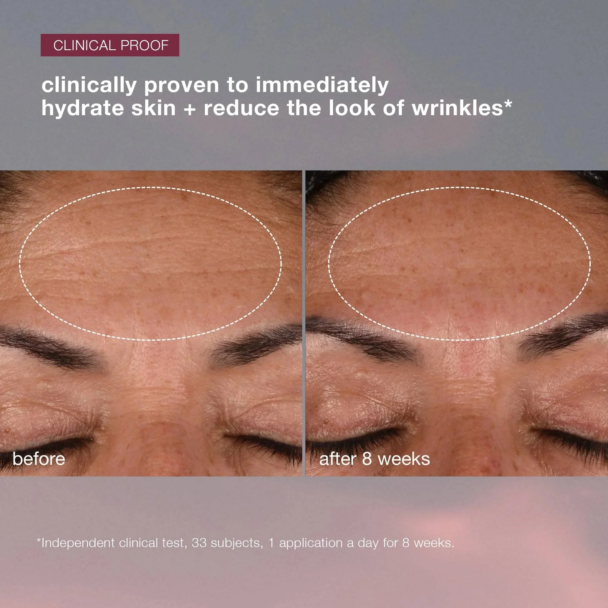 dynamic skin recovery SPF50 moisturiser - Image 4