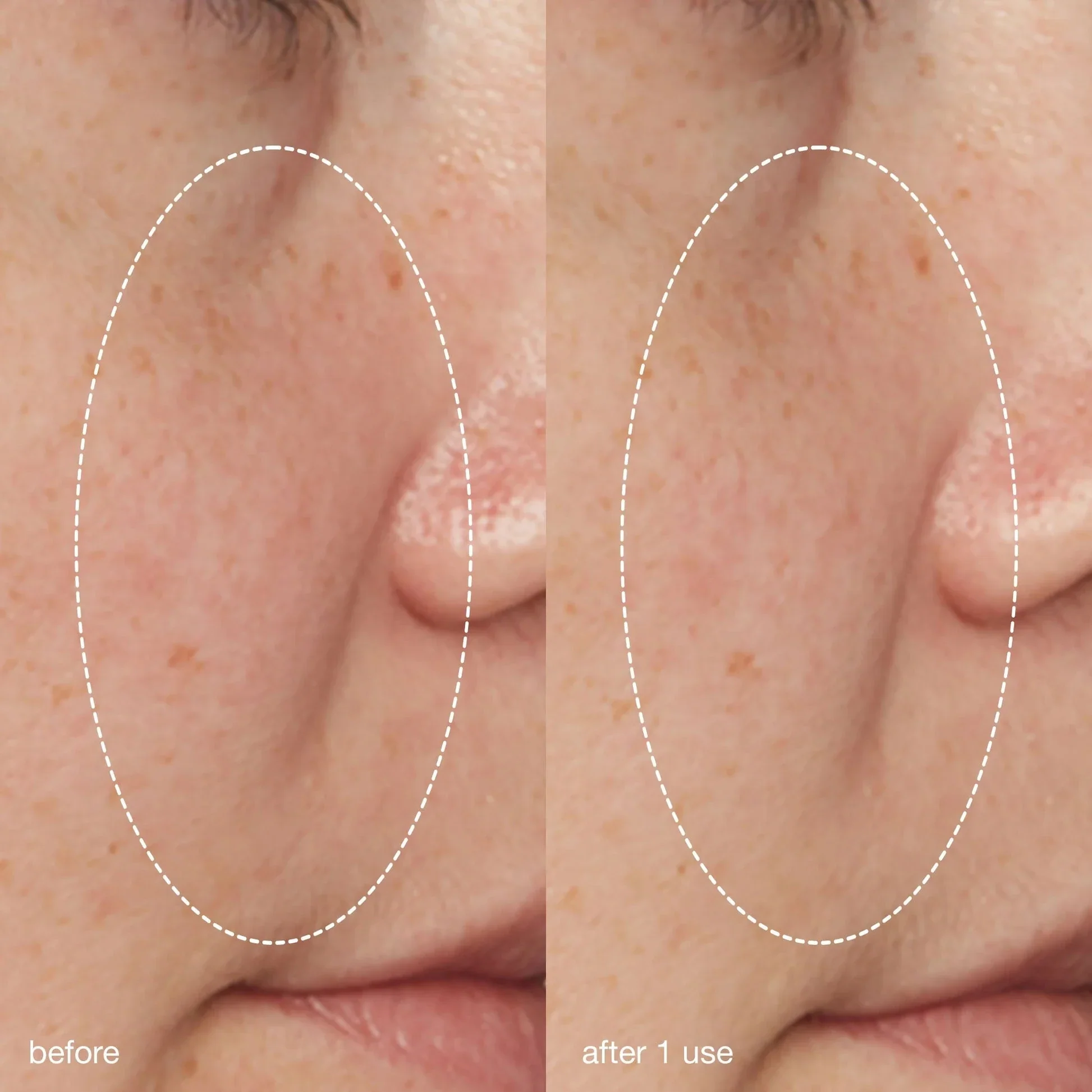 liquid peelfoliant - Image 5