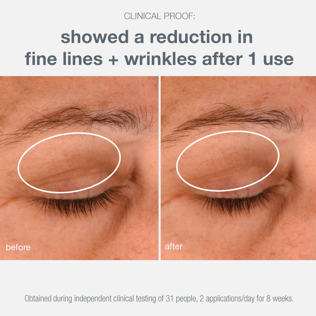 phyto nature lifting eye cream - Image 5