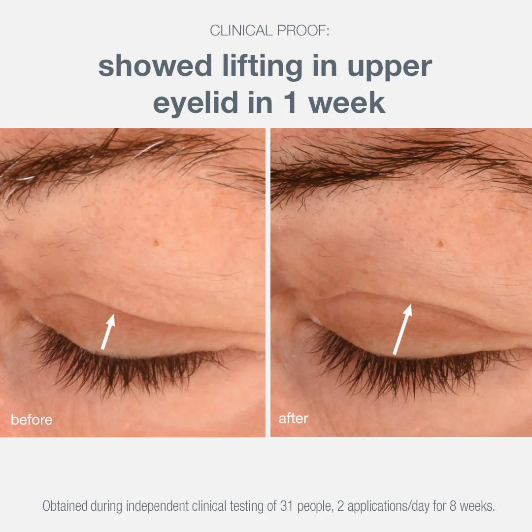 phyto nature lifting eye cream - Image 9