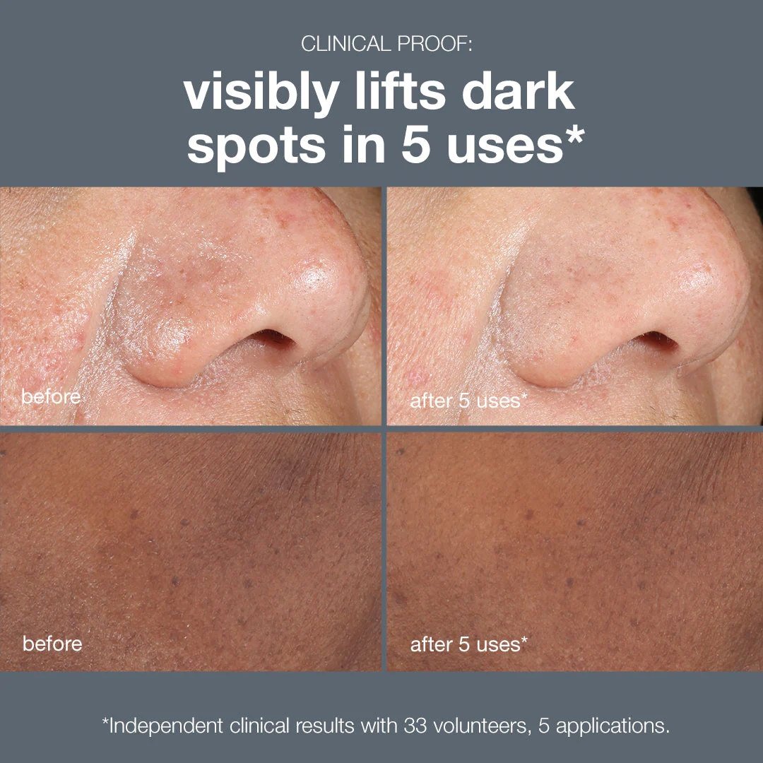 powerbright dark spot peel - Image 6