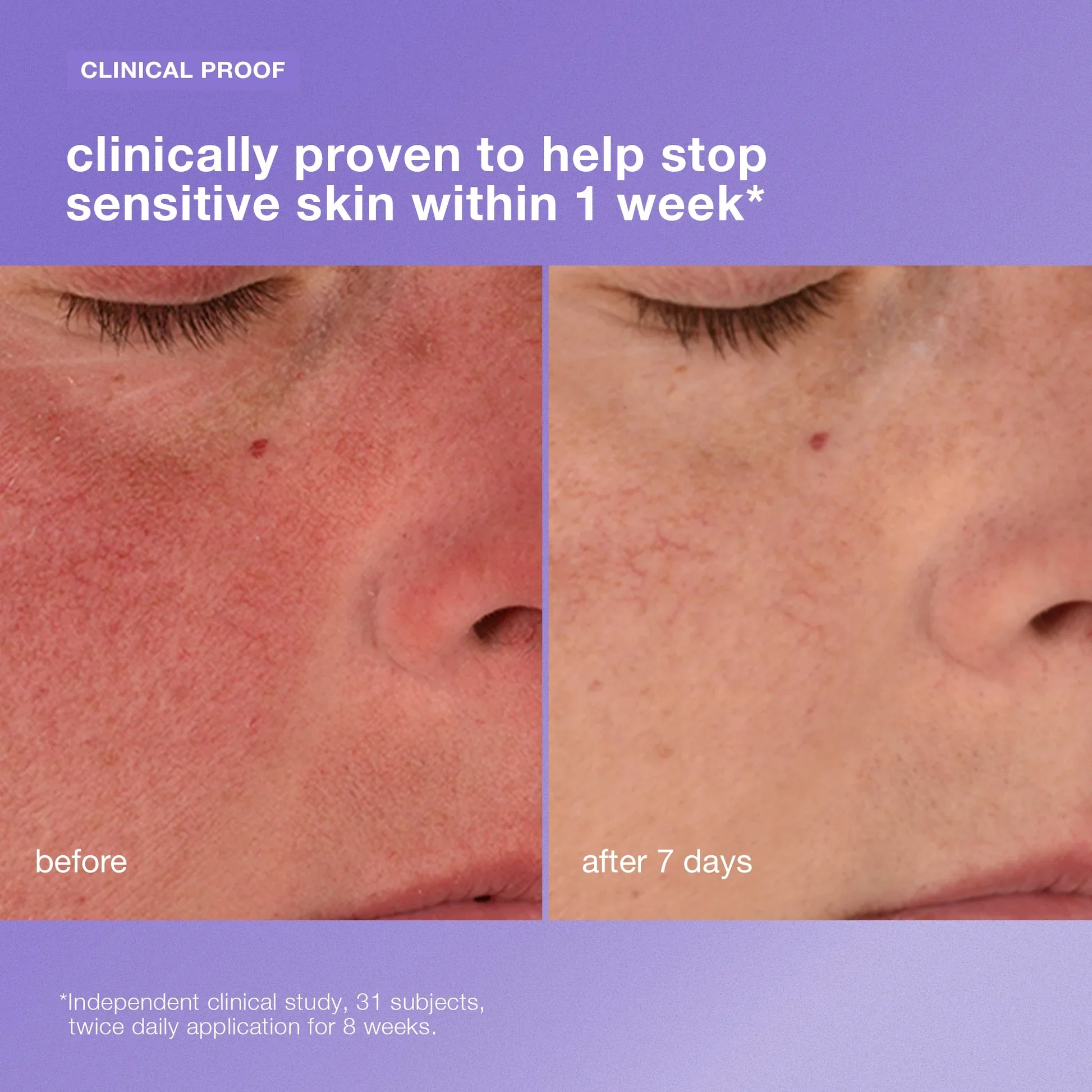 stabilizing repair cream - Image 4